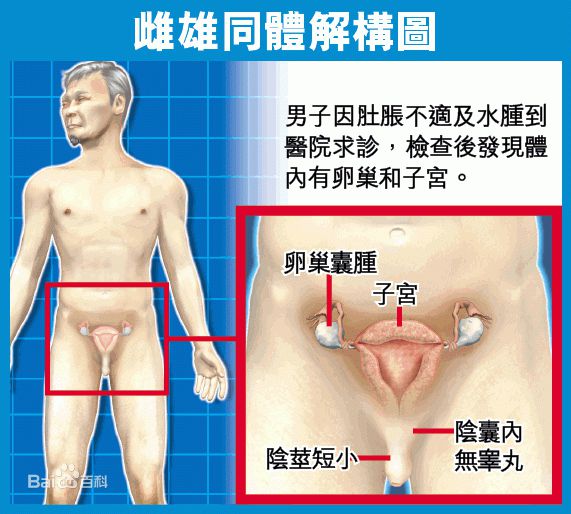 雌雄同体人自己能跟自己生孩子雌雄同体人怎么撒尿心里很痛苦的